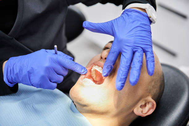 Best Emergency Dental Care for Abscessed Tooth in Jones Valley, CA